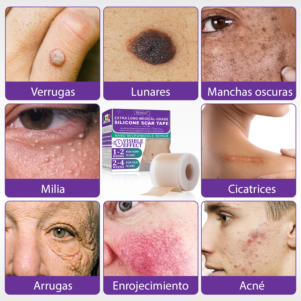 Flysmus® Cinta Nano-Heal: Adiós Cicatrices, Piel Radiante y Suave