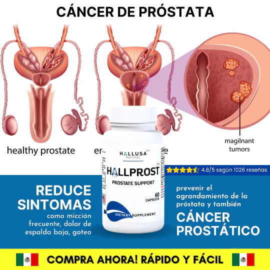 HALLPROST  Tratamiento Completo
