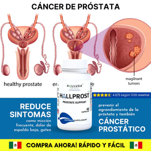 HALLPROST  Tratamiento Completo
