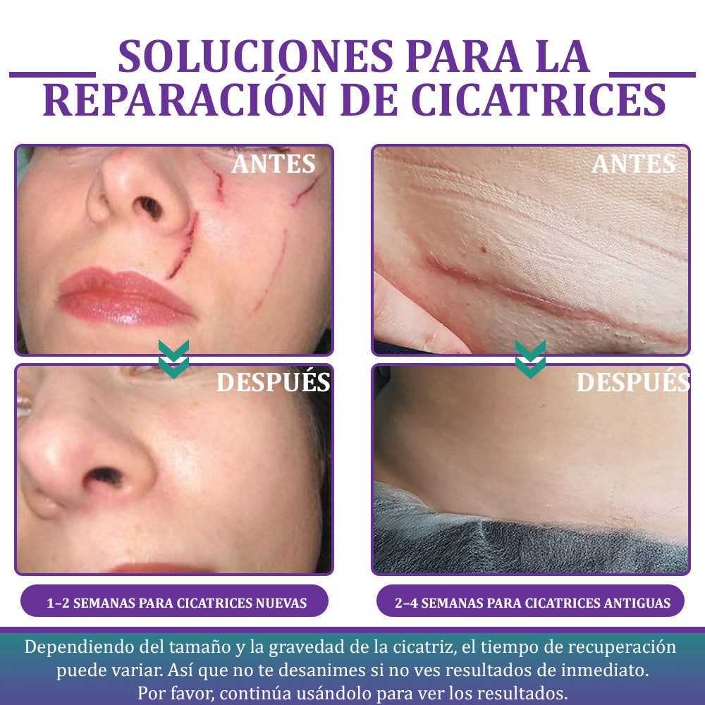 Flysmus® Cinta Nano-Heal: Adiós Cicatrices, Piel Radiante y Suave