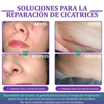 Flysmus® Cinta Nano-Heal: Adiós Cicatrices, Piel Radiante y Suave