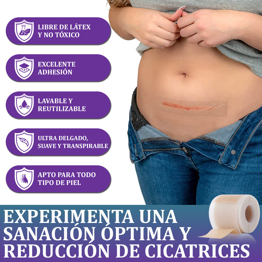 Flysmus® Cinta Nano-Heal: Adiós Cicatrices, Piel Radiante y Suave