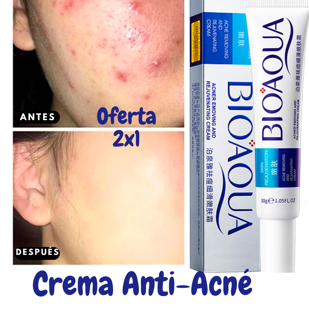 (2X1) Crema Anti Acné "Bioaqua" Promoción Especial⌛