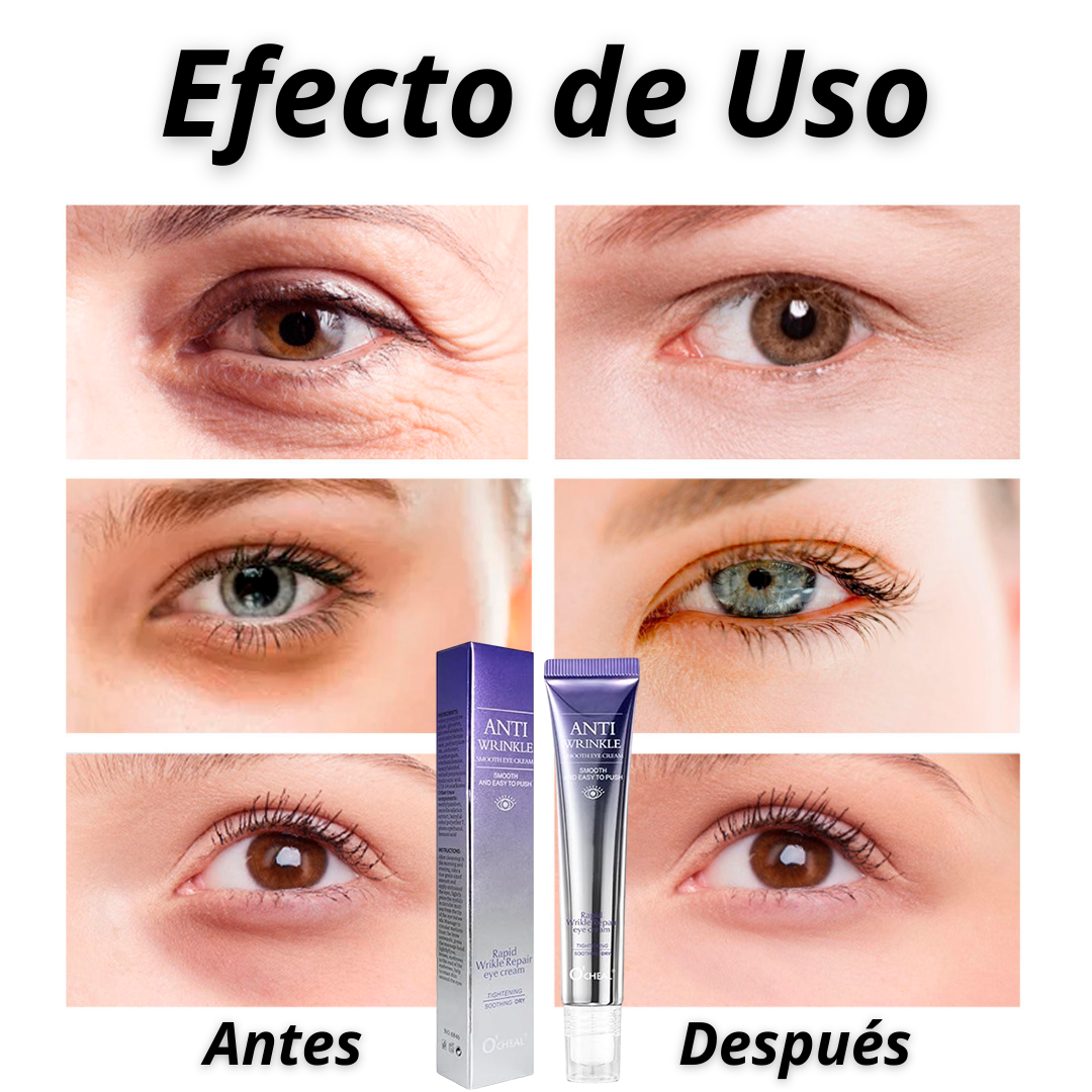"Oferta 2x1" Roller/Crema Anti-Ojeras y Arrugas con Colágeno