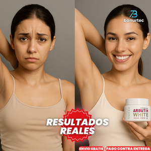 Oferta Especial: ArbutinWhite™  Crema Blanqueadora De Nicotinamida y Arbutina
