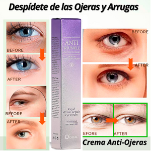 "Oferta 2x1" Roller/Crema Anti-Ojeras y Arrugas con Colágeno