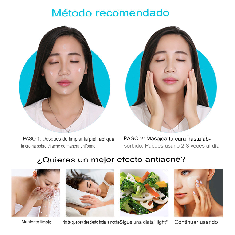 (2X1) Crema Anti Acné "Bioaqua" Promoción Especial⌛